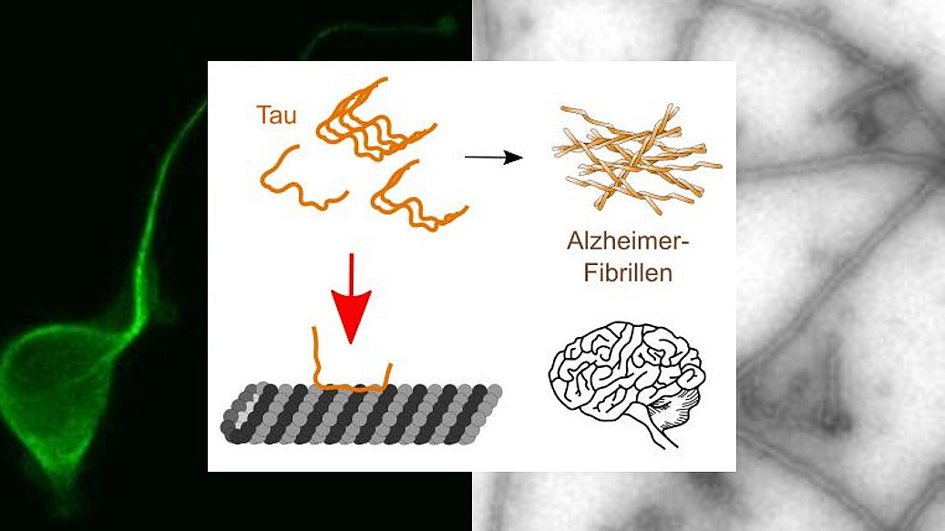 Eine Collage aus drei Elementen; links: Eine gr&uuml;n leuchtende Zelle vor schwarzem Hintergrund; mittig: eine schematische Darstellung verklumpender Tau-Proteine; rechts: eine mikroskopische Aufnahme zeigt l&auml;ngliche Strukturen.