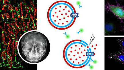 Collage of microscopy images, graphic representations of cellular processes and an X-ray image of a skull.