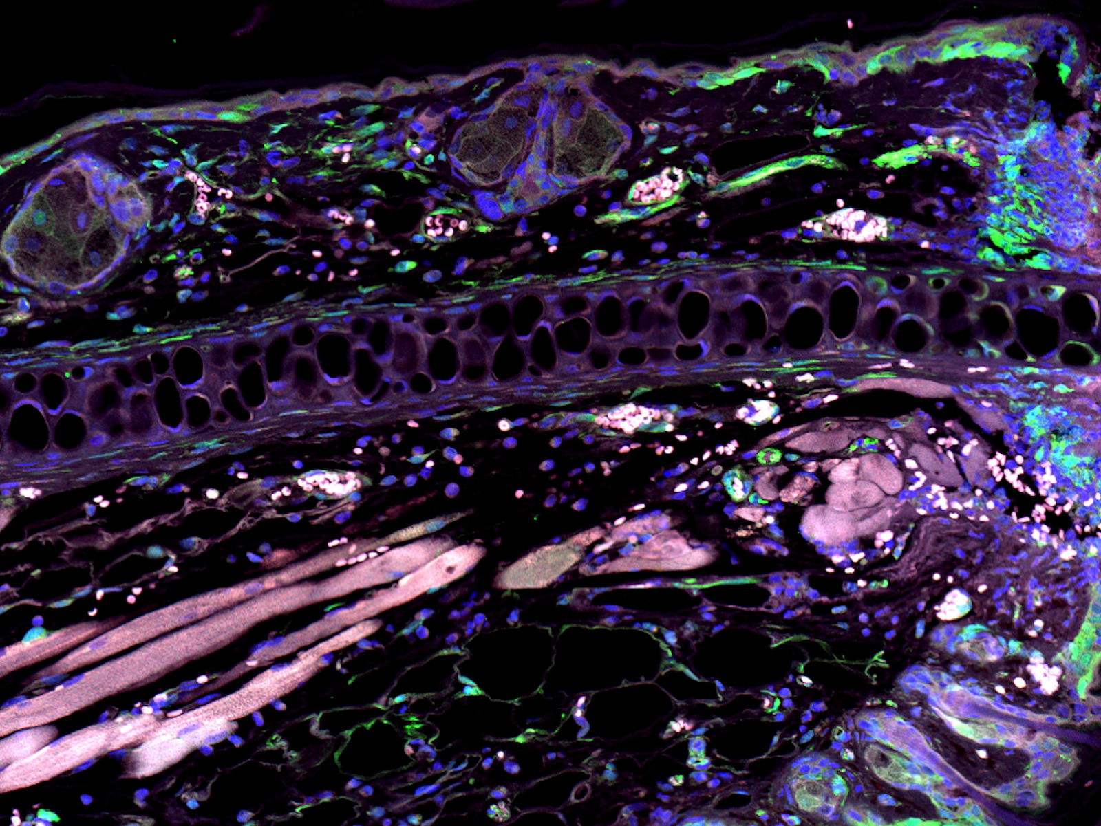 A colourful microscopic image of a tissue