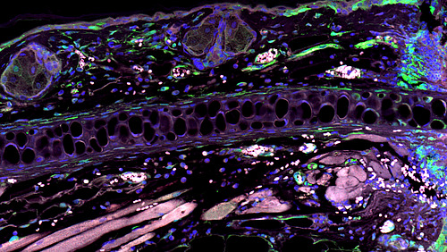 A colourful microscopic image of a tissue