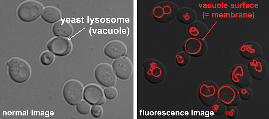Zwei mikroskopische Aufnahmen derselben Zellen. Die linke ist beschriftet mit "normal image", die rechte mit "fluorescence image". Links ist ein Bereich der Zellen beschriftet mit "yeast lysosome (vacuole)", rechts sind in den Zellen rote Kringel zu erkennen, die mit "vacuole surface (=membrane)" beschriftet sind. 