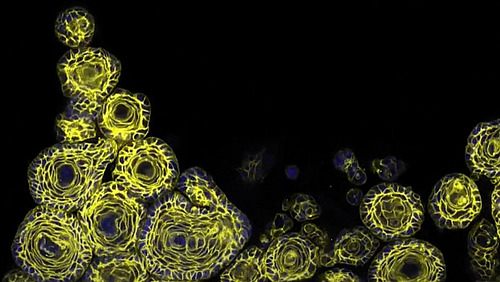 Mikroskopaufnahme in gelb-blau, darauf sind kreisf&ouml;rmige, in kleinere Bereiche unterteilte Strukturen zu erkennen.