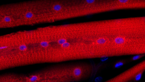 Eine mikroskopische Aufnahme mit blauen Flecken in roten Bereichen; eine Legende weist die blauen Flecken als Zellkerne aus und die roten Bereiche als SERCA.