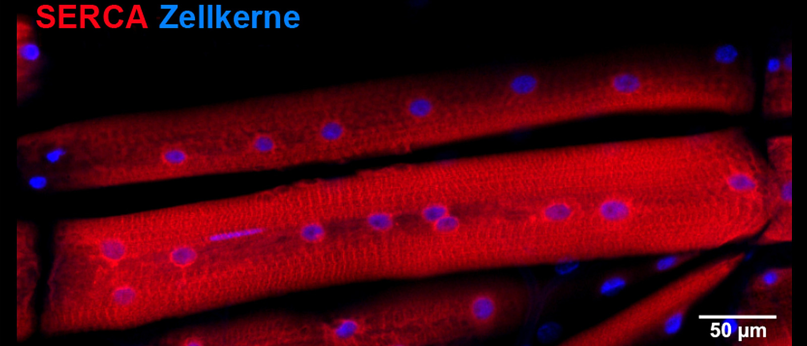 Eine mikroskopische Aufnahme mit blauen Flecken in roten Bereichen; eine Legende weist die blauen Flecken als Zellkerne aus und die roten Bereiche als SERCA.