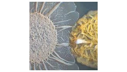 Mikrosopieaufnahme von Bakterienzellen