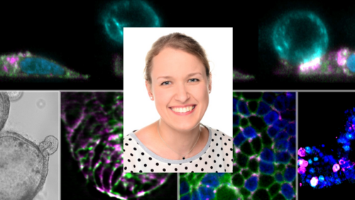 Collage aus einem Portrait einer l&auml;chelnden Frau und Mikroskopie-Aufnahmen