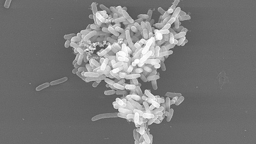 A microscopic image shows a cluster of light-coloured bacterial cells on a dark background.