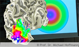 Modell eines Gehirns mit farbigem Muster im Hitnergrund eine bunte Scheibe